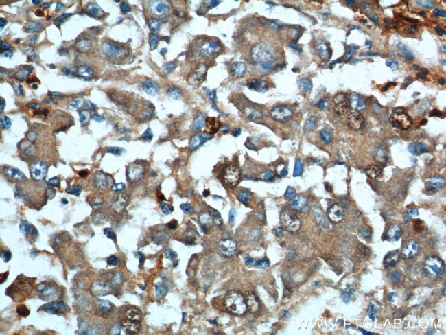 ARG1 Antibody in Immunohistochemistry (Paraffin) (IHC (P))