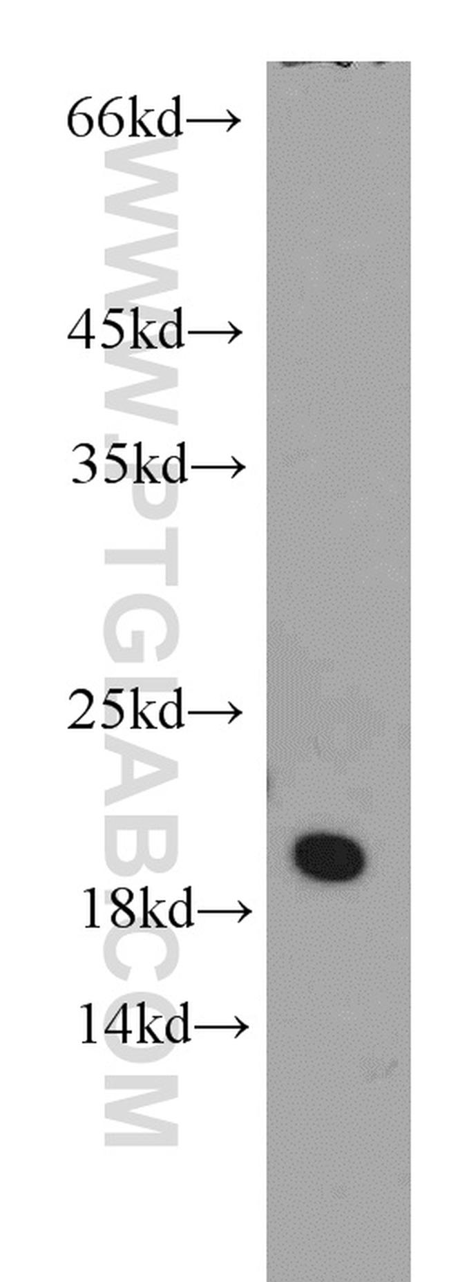 ARL1 Antibody in Western Blot (WB)