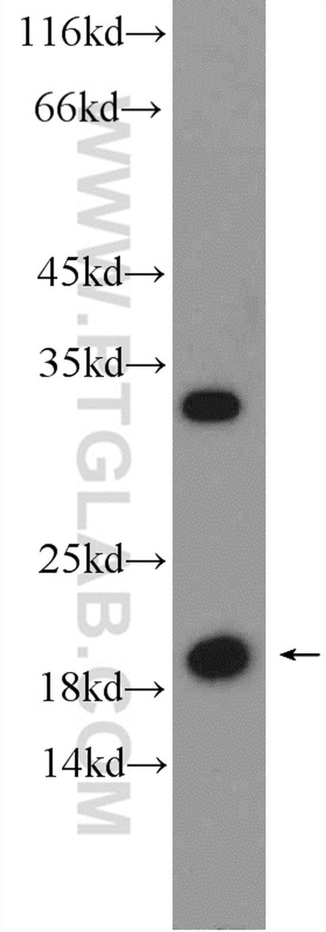 ARL1 Antibody in Western Blot (WB)