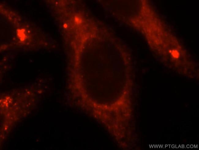 GNB2 Antibody in Immunocytochemistry (ICC/IF)