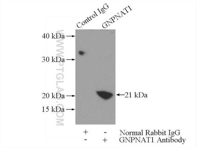 GNPNAT1 Antibody in Immunoprecipitation (IP)