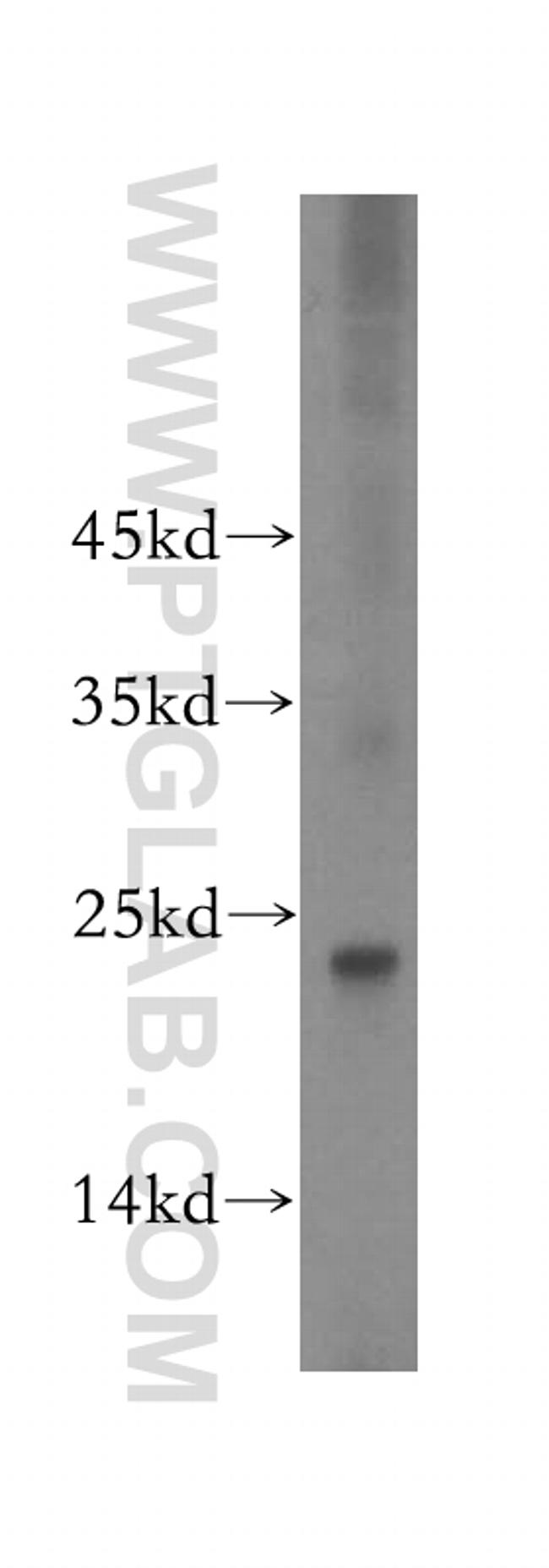 GNPNAT1 Antibody in Western Blot (WB)