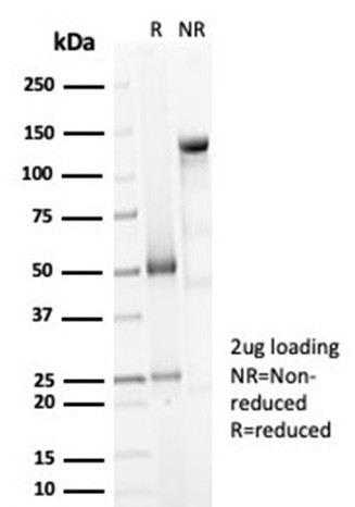 Decorin Antibody in SDS-PAGE (SDS-PAGE)