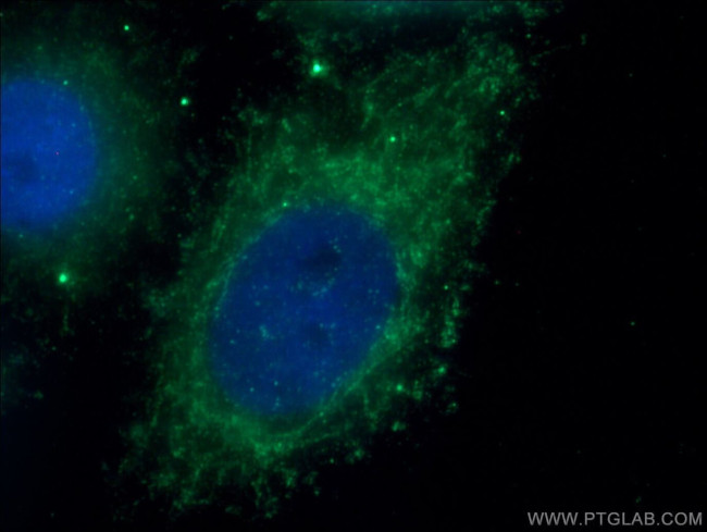 MRPS21 Antibody in Immunocytochemistry (ICC/IF)