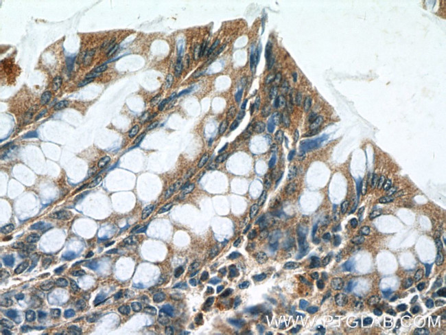 Claudin 3 Antibody in Immunohistochemistry (Paraffin) (IHC (P))