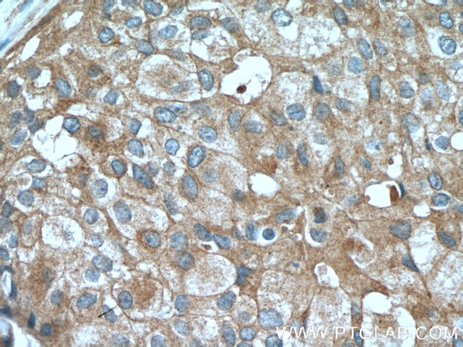 Claudin 3 Antibody in Immunohistochemistry (Paraffin) (IHC (P))