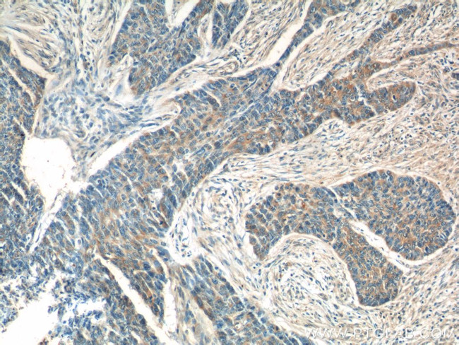 ATAD3 Antibody in Immunohistochemistry (Paraffin) (IHC (P))