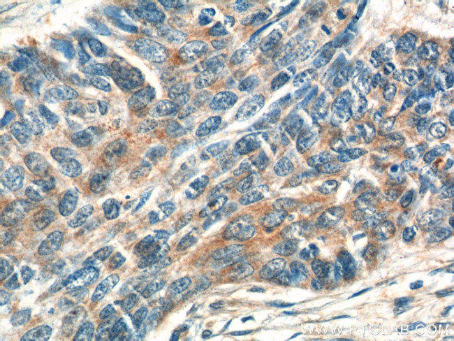 ATAD3 Antibody in Immunohistochemistry (Paraffin) (IHC (P))