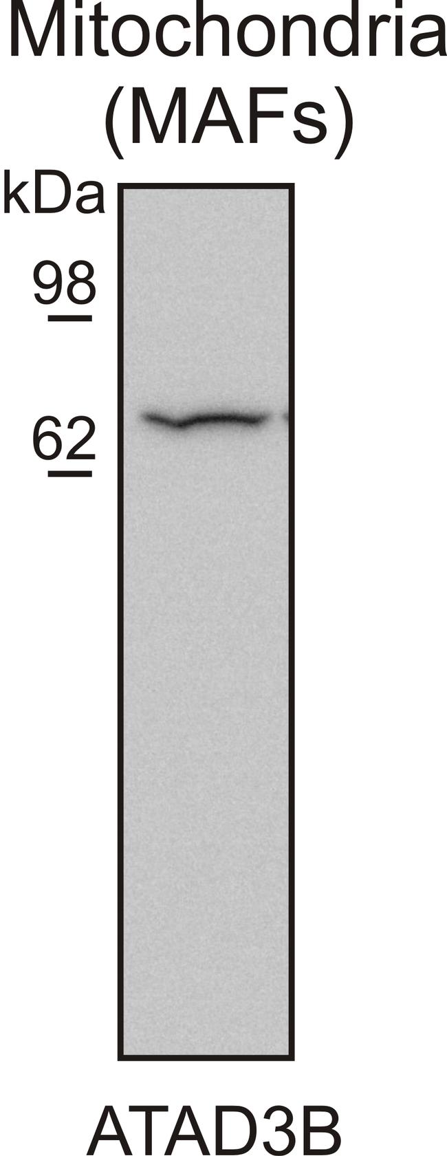 ATAD3 Antibody in Western Blot (WB)