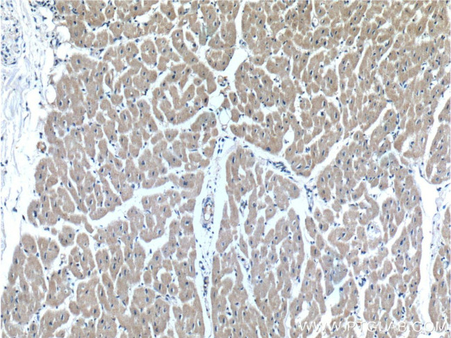 OXSM Antibody in Immunohistochemistry (Paraffin) (IHC (P))