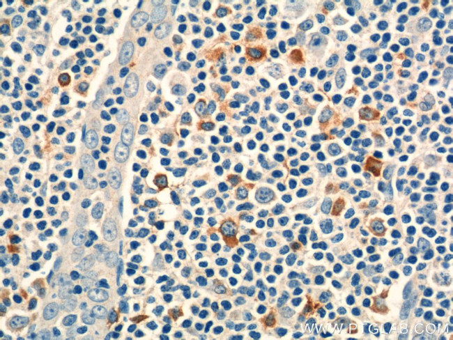 CD244 Antibody in Immunohistochemistry (Paraffin) (IHC (P))