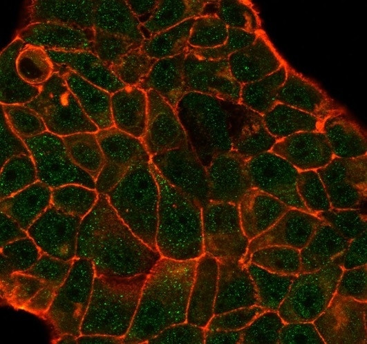 DCP2 (Decapping mRNA 2) Antibody in Immunocytochemistry (ICC/IF)