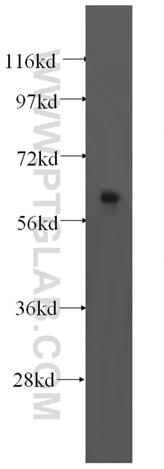 TRMT6 Antibody in Western Blot (WB)