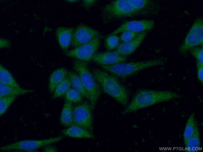 IL1 beta Antibody in Immunocytochemistry (ICC/IF)