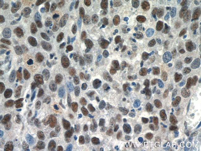 SNRPB Antibody in Immunohistochemistry (Paraffin) (IHC (P))