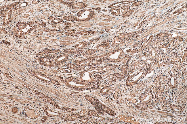 EIF5A2 Antibody in Immunohistochemistry (Paraffin) (IHC (P))