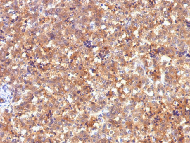 AFP (Alpha Fetoprotein) (Hepatocellular/Germ Cell Tumor Marker) Antibody in Immunohistochemistry (Paraffin) (IHC (P))