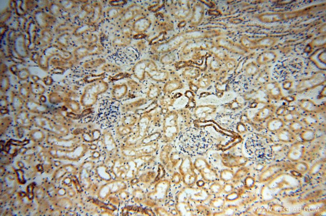 YTHDF1 Antibody in Immunohistochemistry (Paraffin) (IHC (P))