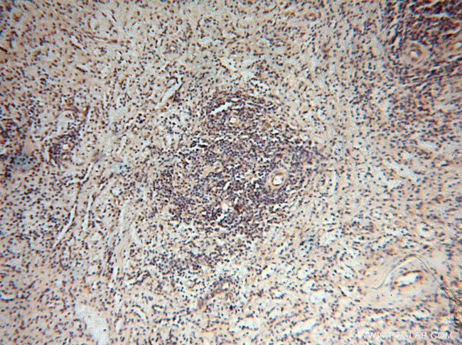 YTHDF1 Antibody in Immunohistochemistry (Paraffin) (IHC (P))