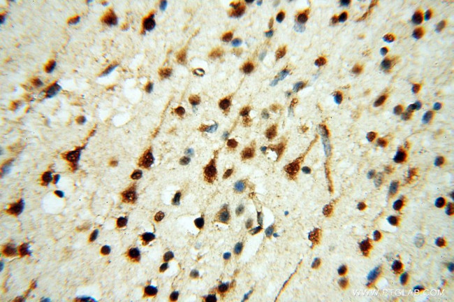 YTHDF1 Antibody in Immunohistochemistry (Paraffin) (IHC (P))