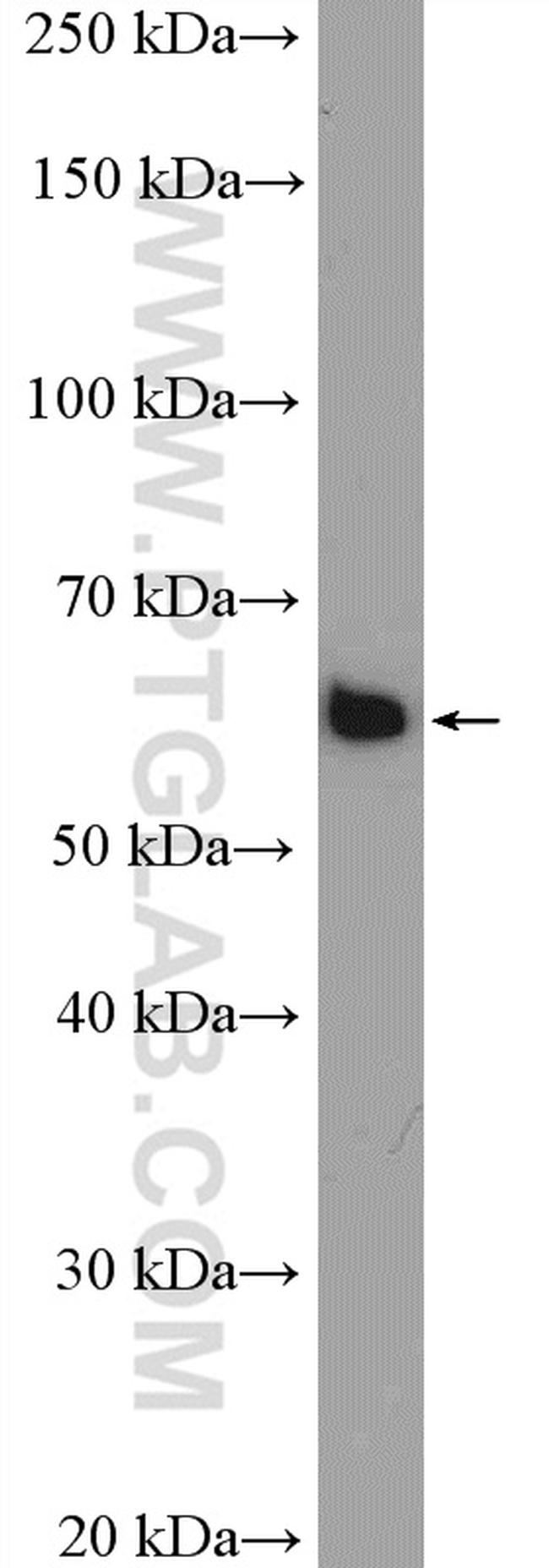 YTHDF1 Antibody in Western Blot (WB)