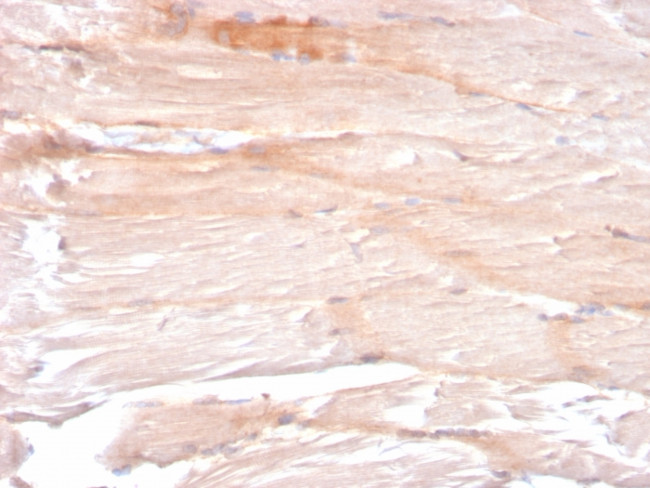 Dystrophin (DMD) (Marker of Duchenne and Becker Muscular Dystrophy) Antibody in Immunohistochemistry (Paraffin) (IHC (P))