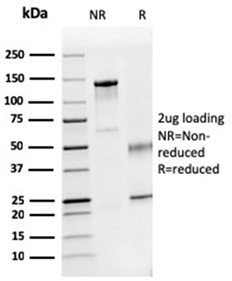 Dystrophin (DMD) (Marker of Duchenne and Becker Muscular Dystrophy) Antibody in SDS-PAGE (SDS-PAGE)