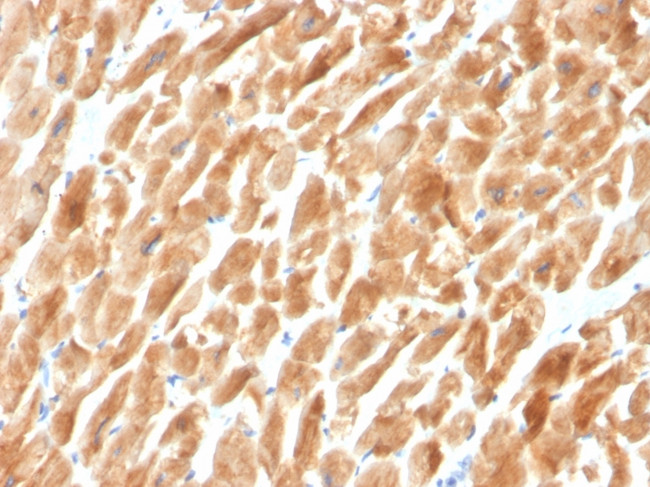 Dystrophin (DMD) Antibody in Immunohistochemistry (Paraffin) (IHC (P))