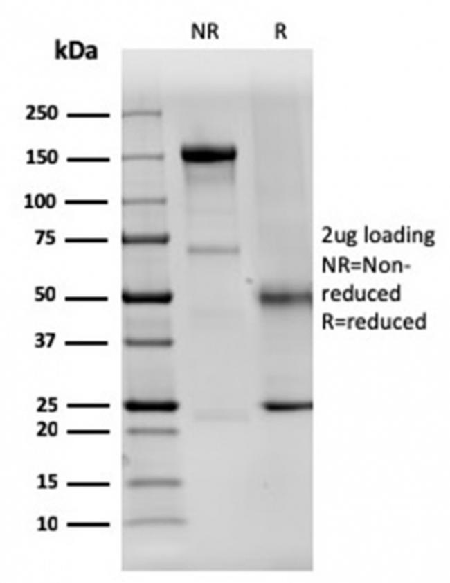 Dystrophin (DMD) Antibody in SDS-PAGE (SDS-PAGE)