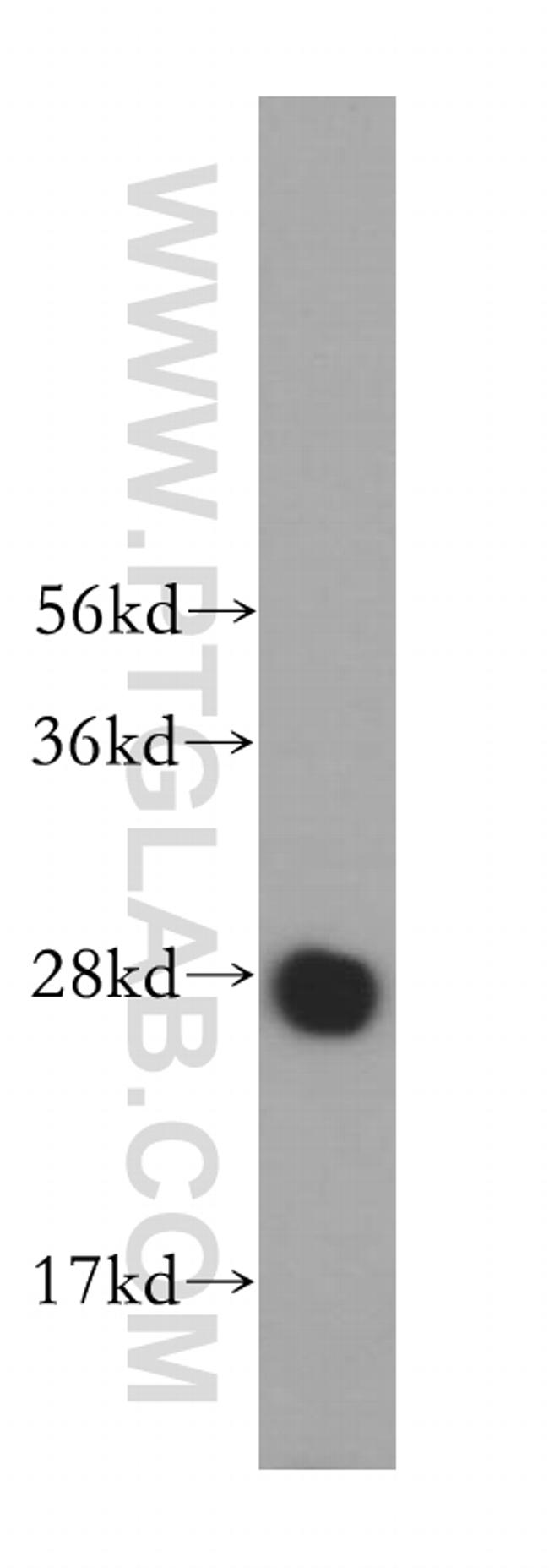 MED20 Antibody in Western Blot (WB)