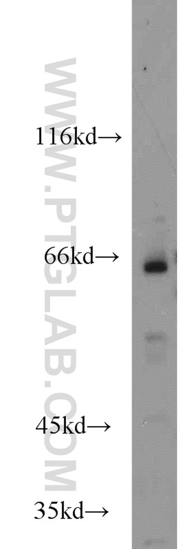 HSF5 Antibody in Western Blot (WB)