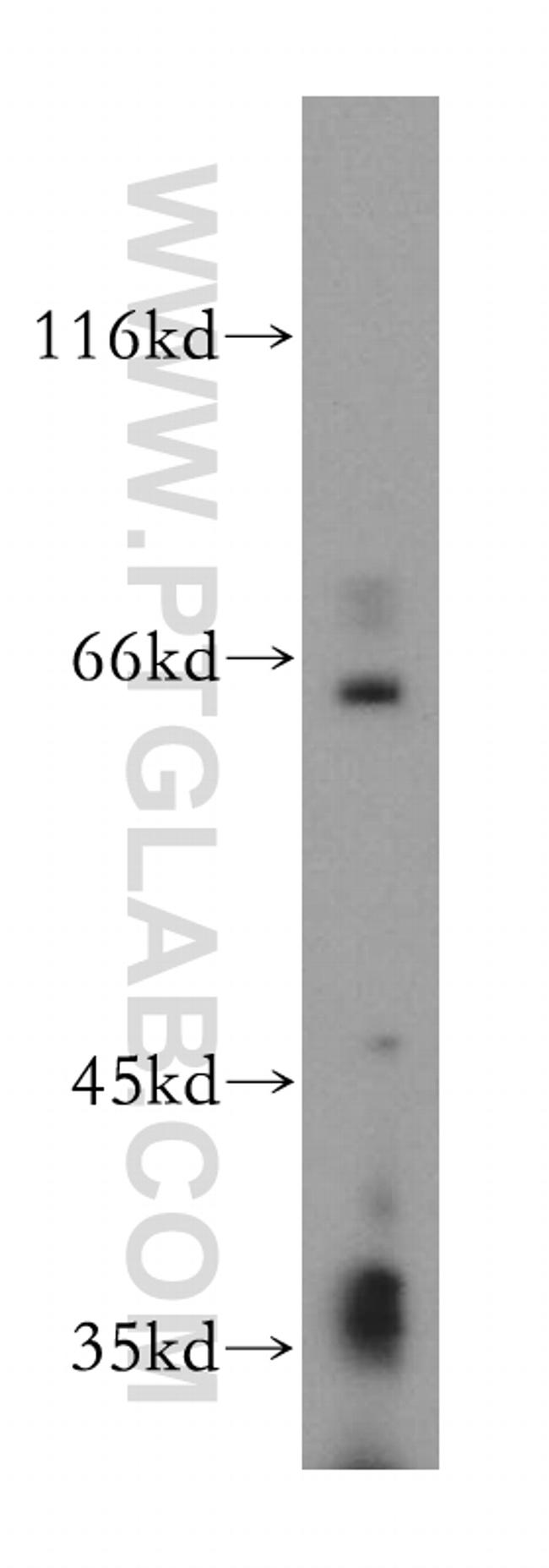 HSF5 Antibody in Western Blot (WB)