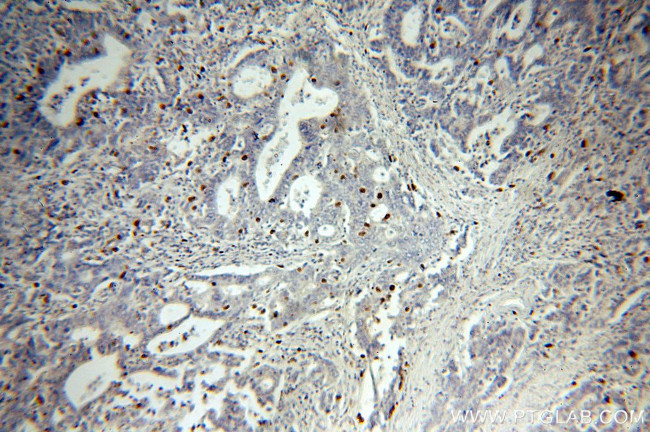 PD-L1/CD274 Antibody in Immunohistochemistry (Paraffin) (IHC (P))