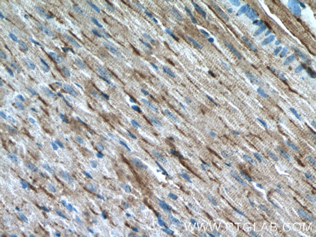 PD-L1/CD274 Antibody in Immunohistochemistry (Paraffin) (IHC (P))