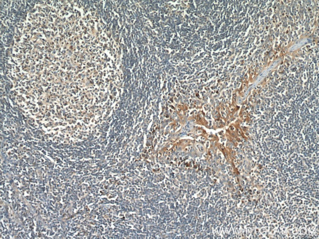 PD-L1/CD274 Antibody in Immunohistochemistry (Paraffin) (IHC (P))