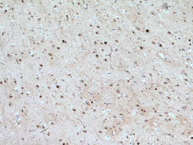 HOXA6 Antibody in Immunohistochemistry (Paraffin) (IHC (P))