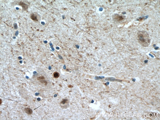 HOXA6 Antibody in Immunohistochemistry (Paraffin) (IHC (P))