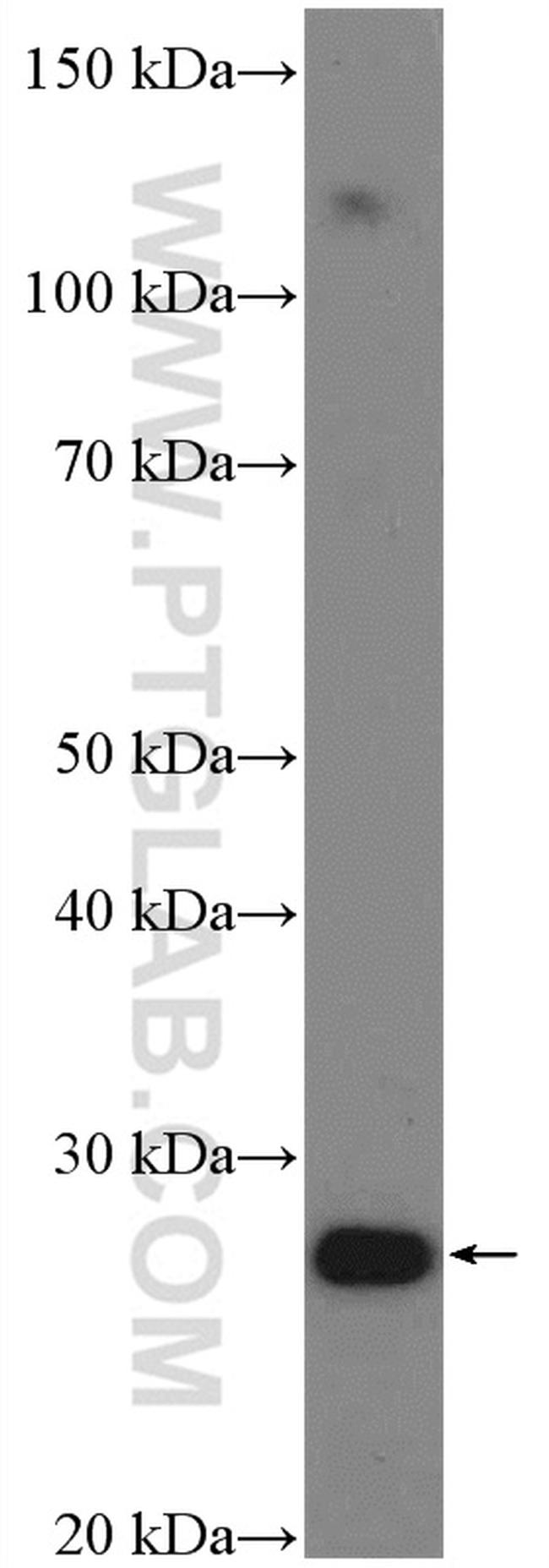 HOXA6 Antibody in Western Blot (WB)