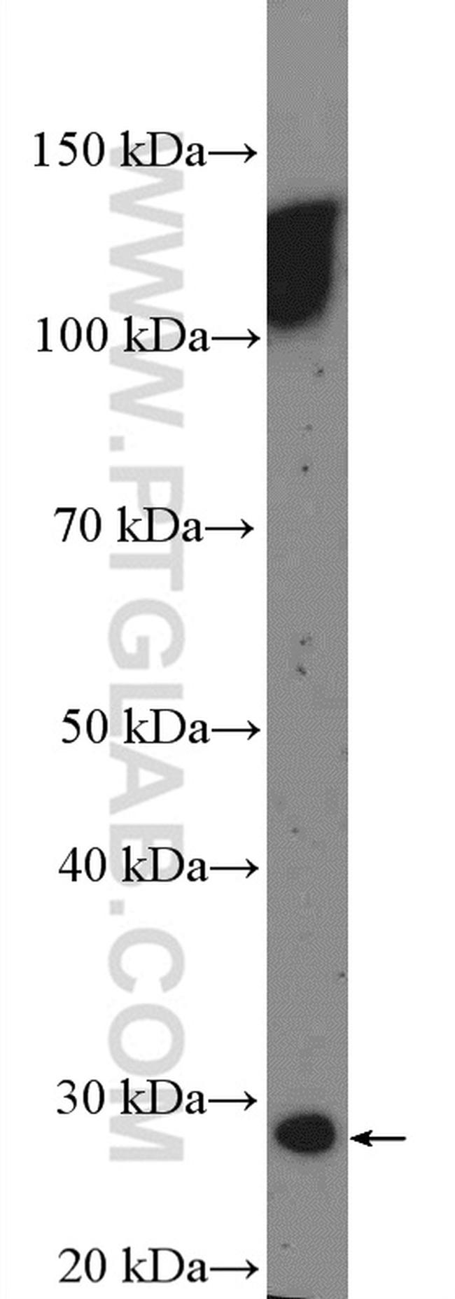 HOXA6 Antibody in Western Blot (WB)