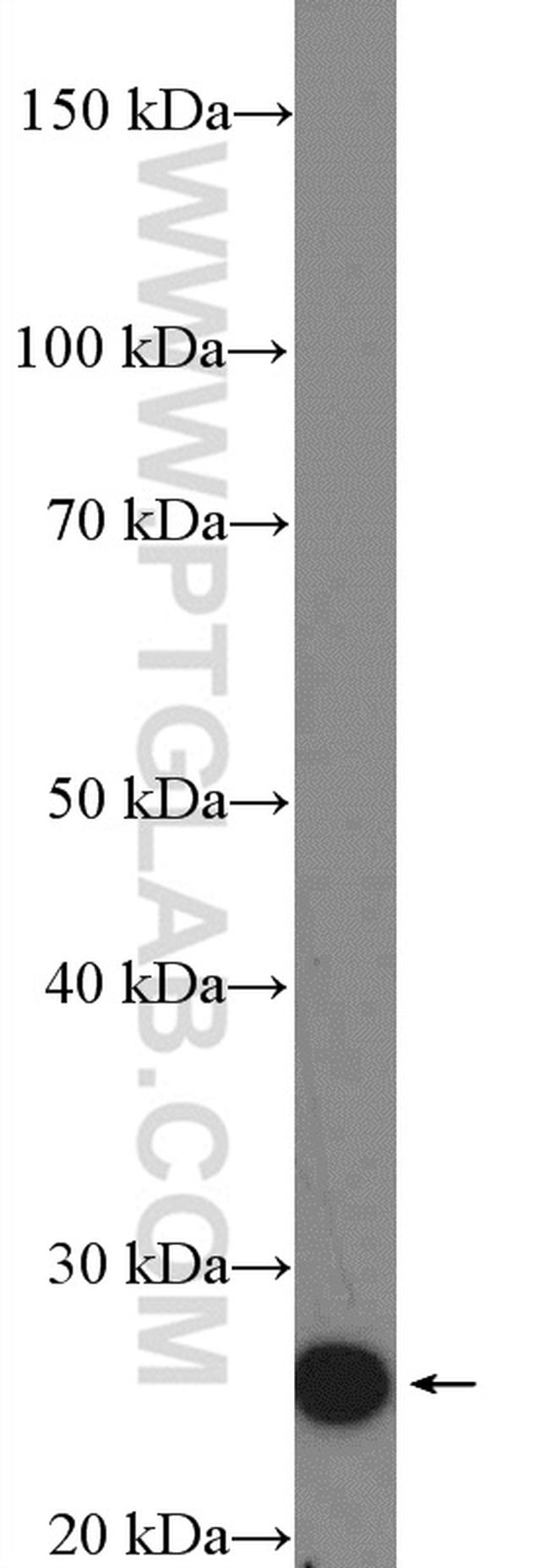 HOXA6 Antibody in Western Blot (WB)