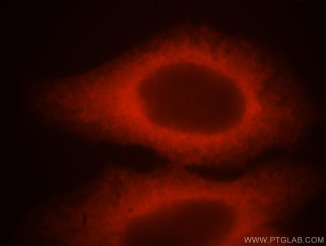 HSP27 Antibody in Immunocytochemistry (ICC/IF)