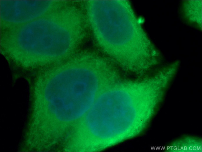 HSP27 Antibody in Immunocytochemistry (ICC/IF)