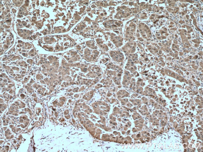 HSP27 Antibody in Immunohistochemistry (Paraffin) (IHC (P))