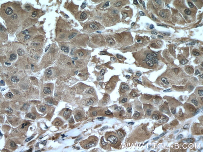 HSP27 Antibody in Immunohistochemistry (Paraffin) (IHC (P))