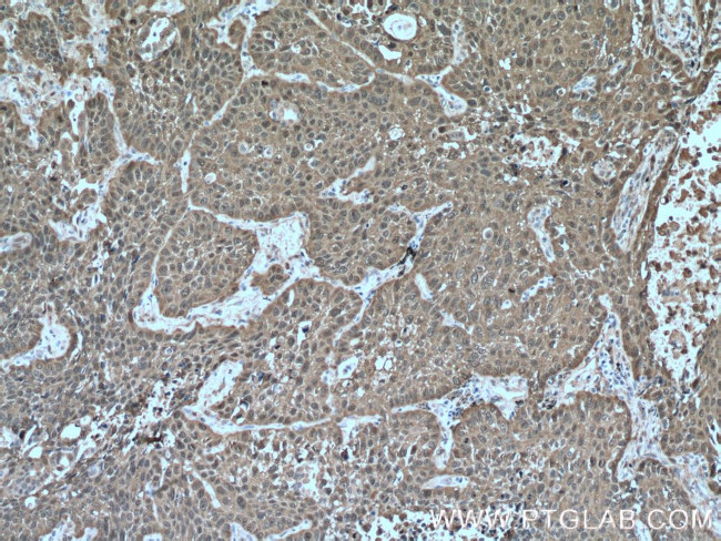 HSP27 Antibody in Immunohistochemistry (Paraffin) (IHC (P))