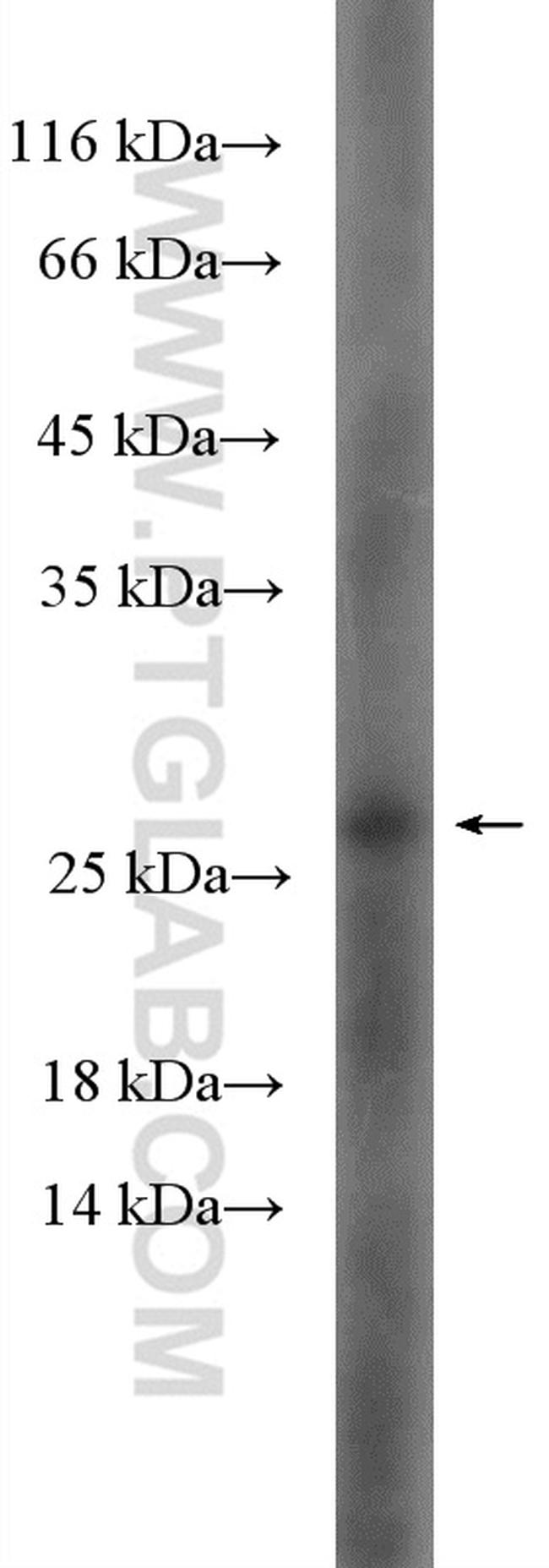 HSP27 Antibody in Western Blot (WB)