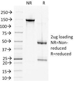 Desmoglein-2 (DSG2) Antibody in SDS-PAGE (SDS-PAGE)