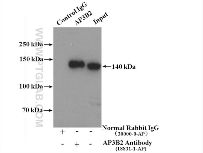 AP3B2 Antibody in Immunoprecipitation (IP)