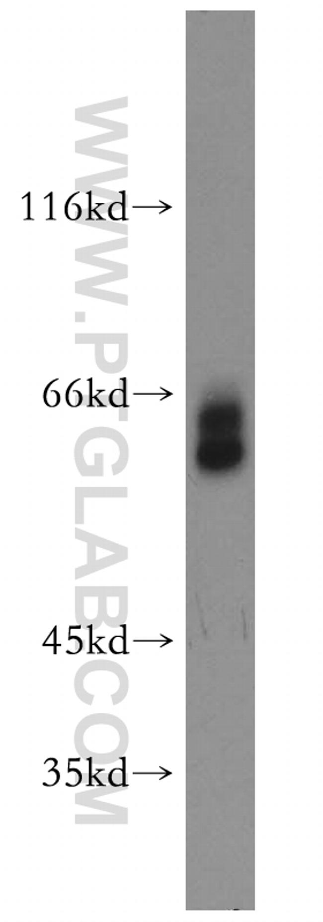 PSAP Antibody in Western Blot (WB)