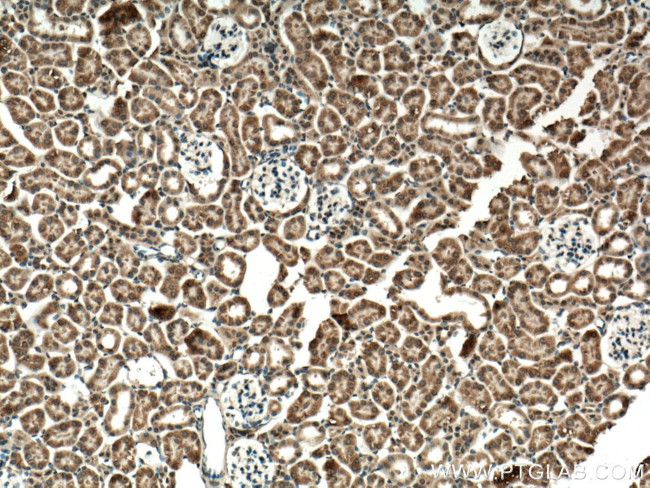 P62/SQSTM1 Polyclonal Antibody (18420-1-AP)